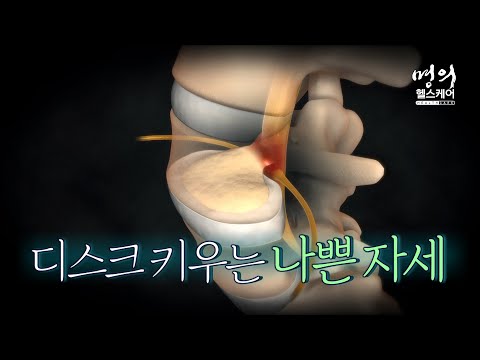 명의 헬스케어 - 디스크 키우는 나쁜 자세