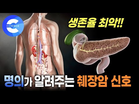 발견하기 어려운 췌장암 생존율 12% | 췌장암의 이상 신호 | 명의