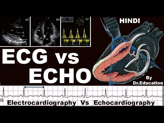 Rx Heart Epi 16 E : Ecg Vs Echo (Eng) | Electrocardiography Vs  Echocardiography | Dr.Education - Youtube