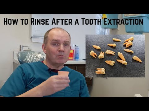 How to rinse gently after dental surgery.