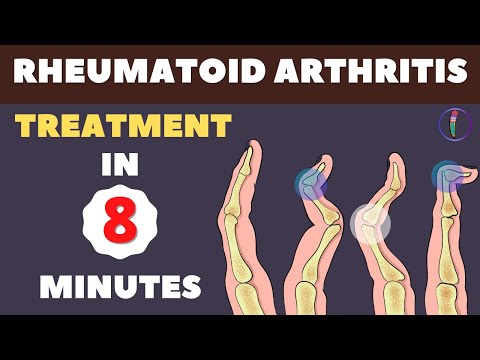 Rheumatoid Arthritis Treatment - New Medicines and Updates